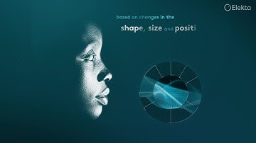 See the difference with Elekta Unity