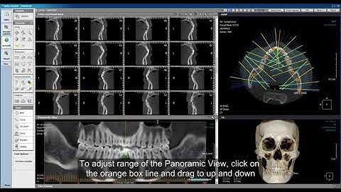 Xelis Dental Case Tutorial Cross Sectional View