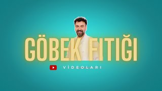 Tüp Mide Ameliyatı Ile Birlikte Göbek Fıtığı Ameliyatı- Gastric Sleeve And Umbilical Hernia