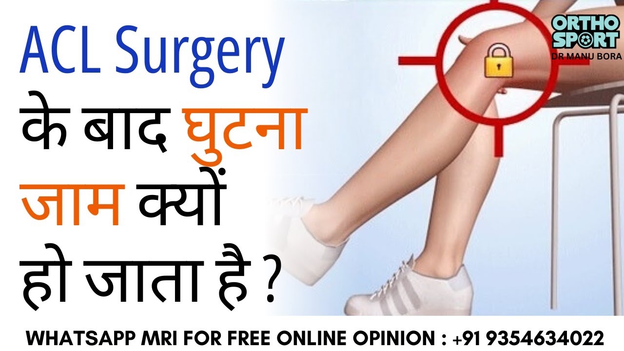 ACL Surgery के बाद घुटना जाम क्यों हो जाता हैं ? Why does the knee