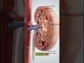 Title: "Kick Kidney Stones Fast!" Hashtags:#KidneyStoneRelief #HealthHacks#PainNoMore #WellnessTips