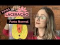 Tipos de laceração do parto normal