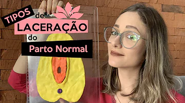 Quanto tempo demora para cicatrizar os pontos do parto normal?