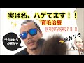 【実は私、ハゲてます】告白してラクになります！！薄毛治療開始！！
