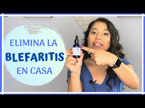 Vídeo: Blefaritis: Tratamiento De La Blefaritis Con Remedios Y Métodos Caseros
