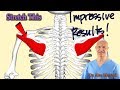 INFRASPINATUS MUSCLE RELEASE - Shoulder Blade/Mid Back Pain Disappears - Dr Alan Mandell, DC