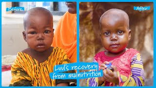 Luul’s Recovery From Severe Malnutrition In Somalia | Unicef