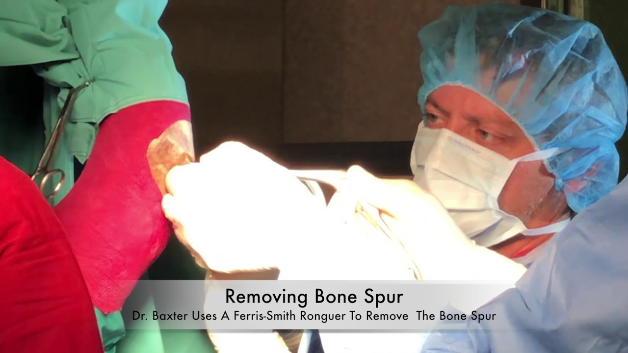 Equine Arthroscopy Removing Large Bone Spur YouTube