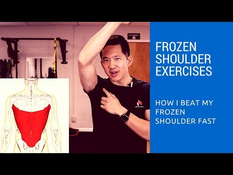 Frozen shoulder exercises - how I got relief in just two days
