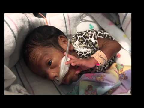 Micro Preemie Born At 24 Weeks 5 Days At 1lb 4oz Youtube Micro Preemie Born At 24 Weeks 5 Days At 1lb 4oz Youtube