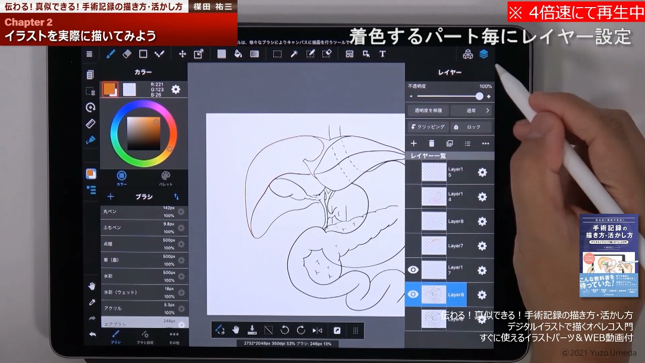 Chapter 2 イラストを描いてみよう 下絵と色塗り 伝わる 真似できる 手術記録の描き方 活かし方 デジタルイラストで描くオペレコ入門 すぐに使えるイラストパーツ Web動画付 Youtube