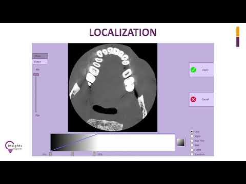 Insights Diagnostic - iRYS Software Tutorial - Localization of a Region of Interest