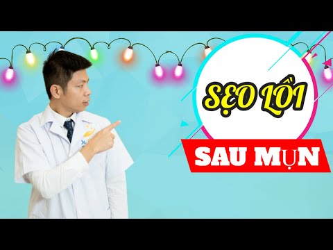 Sẹo lồi sau mụn trứng cá xử lý thế nào-DR.NGỌC