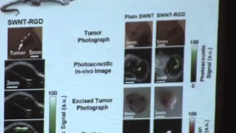 Micro Medicine, Nano Technology and Cancer, Dr. Xiaoyuan (Shawn) Chen