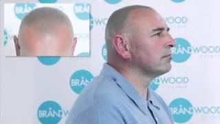 Brandwood Clinic - Watch a Scalp MicroPigmentation Treatment