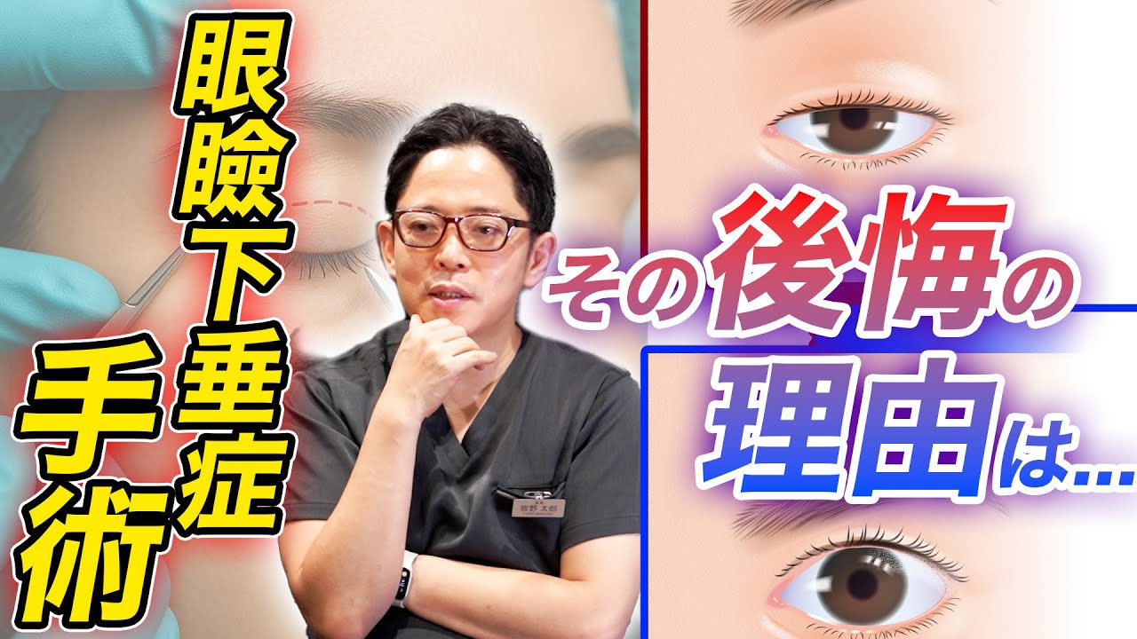 【眼瞼下垂症手術】「切開手術」を後悔した理由とは？