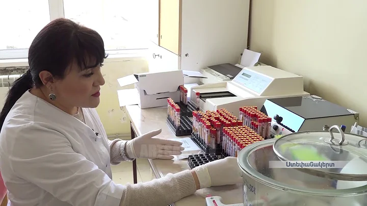 Դեկտեմբերի 1-ը ՁԻԱՀ-ի դեմ պայքարի համաշխարհային օրն է