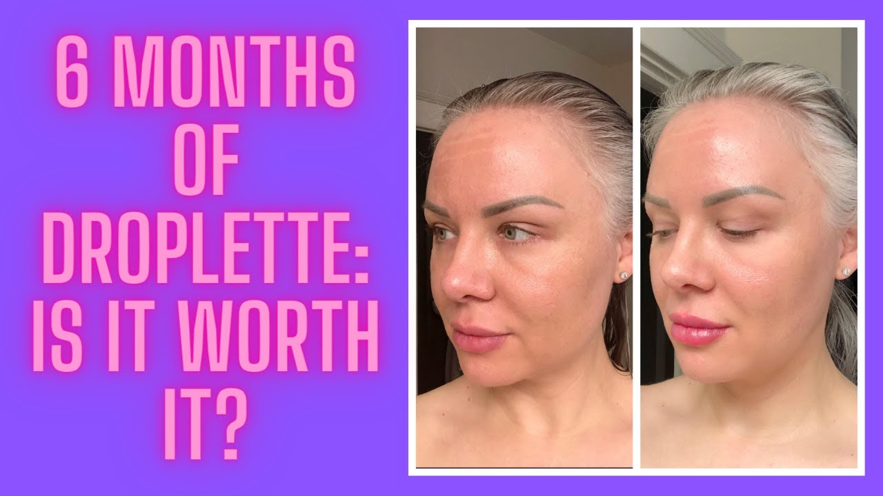 6 Month Update of Droplette: Is it worth the investment??? - YouTube