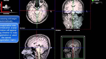 nordicBrainEx v2.1 How to process DSC