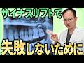 あなたはサイナスリフトが本当に必要？サイナスリフトで後悔しないために知っておくべきことを症例とともに解説します！