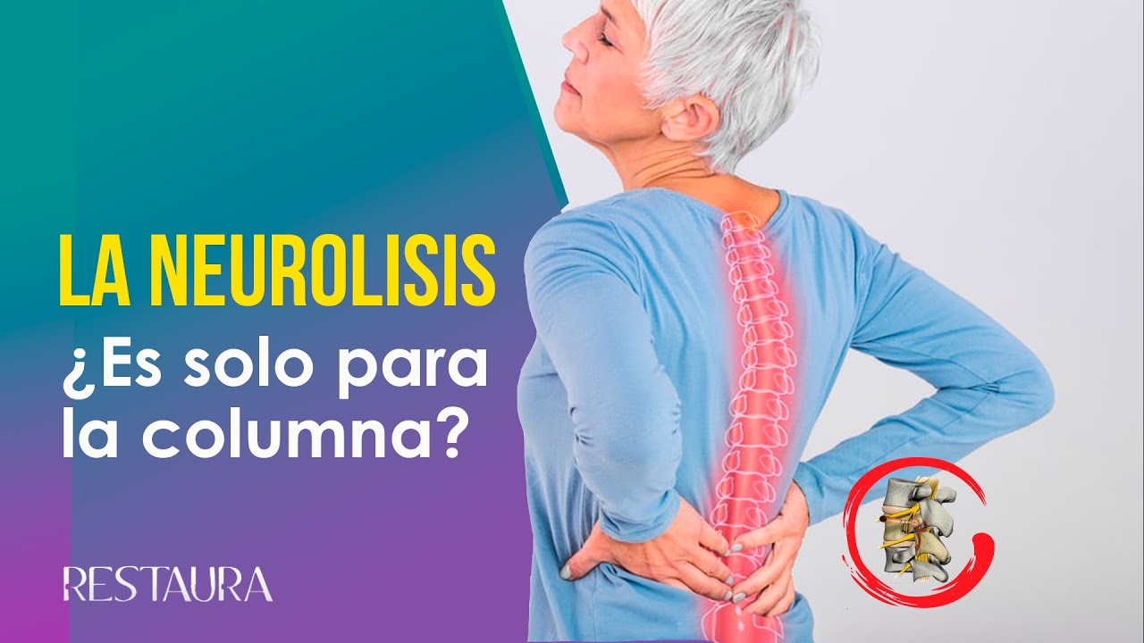 La neurolisis ¿Solo sirve para la columna?
