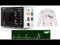 Mindray benevision n series  how to make a 12l ecg and send it to muse