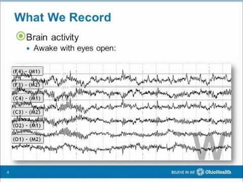 Brain Activity During Sleep - YouTube