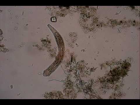 Pond Water Organisms - YouTube