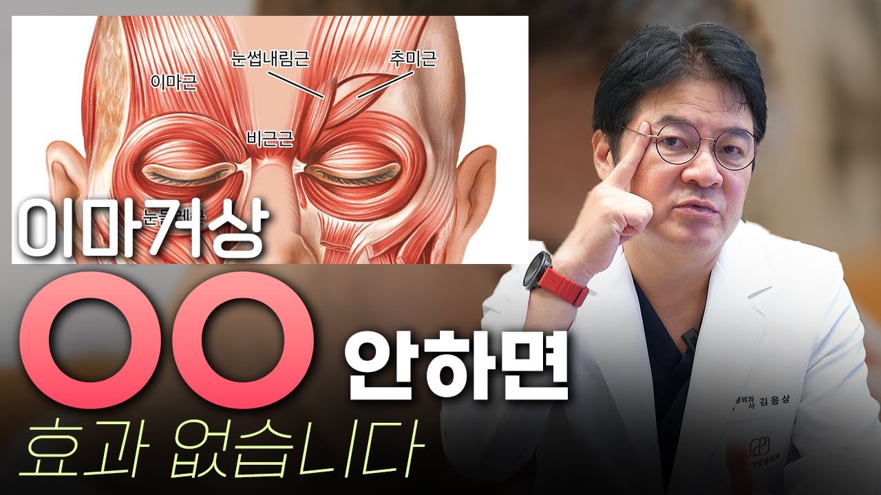 이마거상 눈썹 내림근 박리