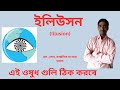 Illusion homeopathic medicine  best homeo medicine for mental health homeopathy bengali