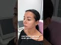 Комплексное преображение и омоложение Full Face: индивидуальный план процедур