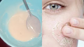 BUKTIKAN SEKARANG !! CARA MENGHILANGKAN FLEK HITAM DALAM 5 MENIT SAJA