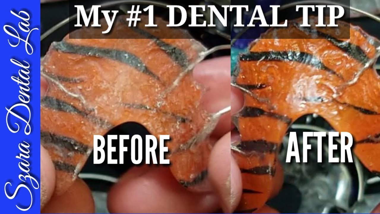 Best Ortho Dental Lab Technician Lesson by Szara Dental