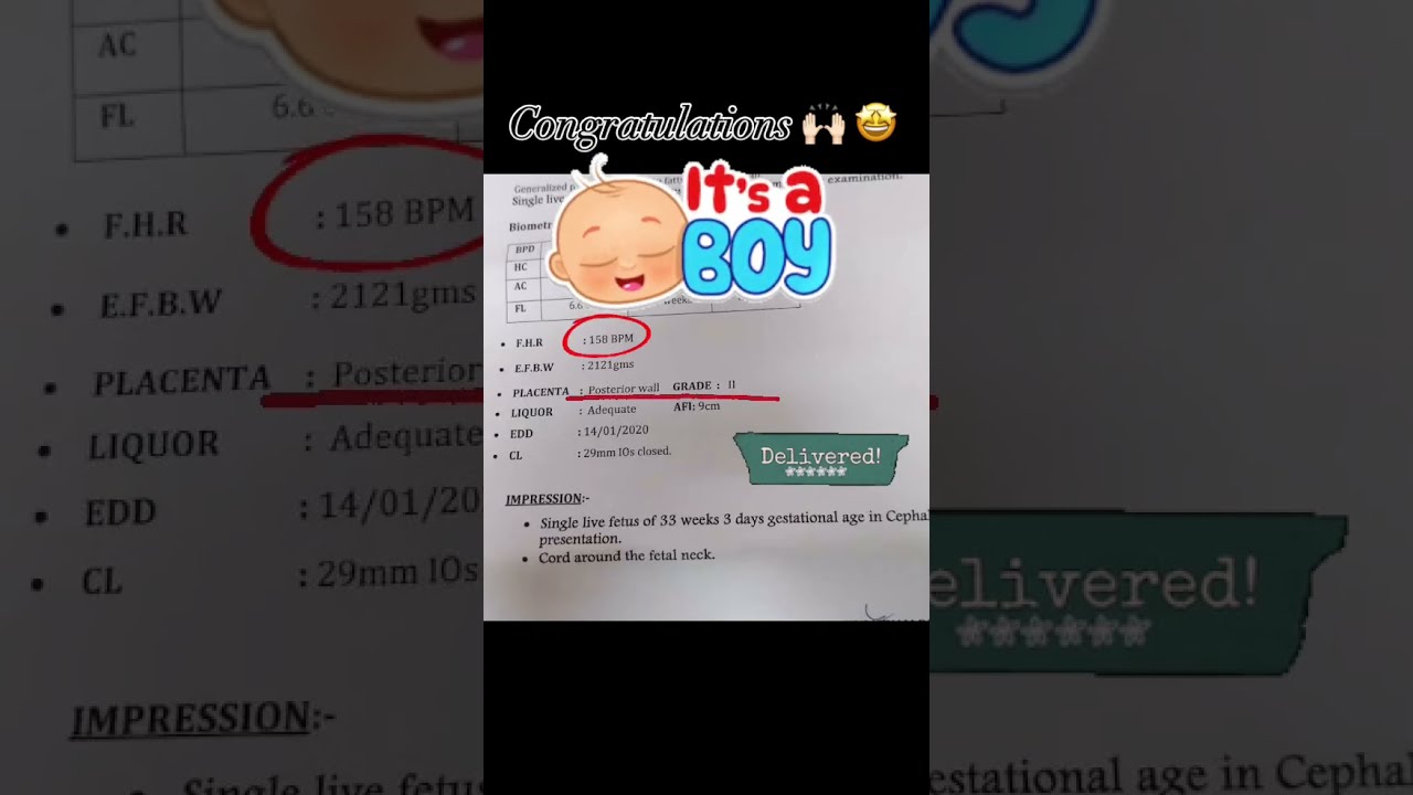 Baby Boy Scan Report It S A Ultrasound Treadingshorts Viralvideo Shorts