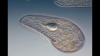 protozoa helminták fajai a legkevésbé mérgező készítmények férgek számára