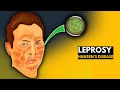 Leprosy hansens disease everything you need to know