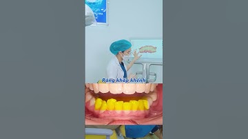 Mất răng có niềng răng được không? | Lạc Việt Intech Niềng Răng #shorts