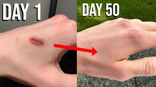 Satisfying Wound Healing Timelapse (50 Days = 50 Seconds)