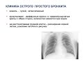 Лекция № 9 Заболевания органов дыхания у детей