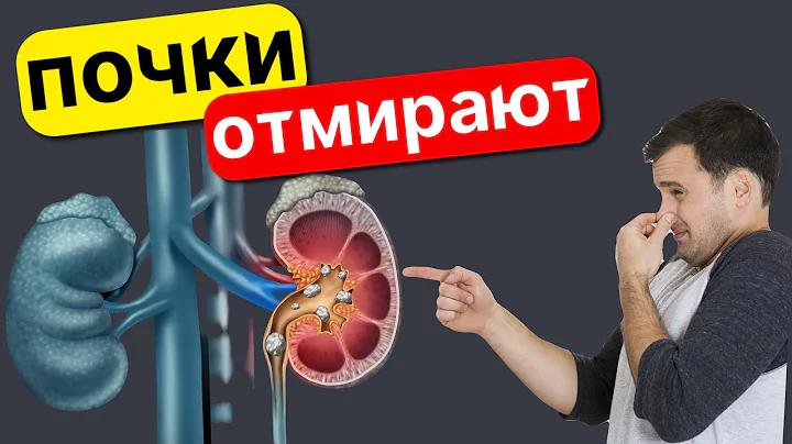 12 симптомов того, что ваши ПОЧКИ ОТМИРАЮТ! Что НЕЛЬЗЯ делать при воспалении почек?