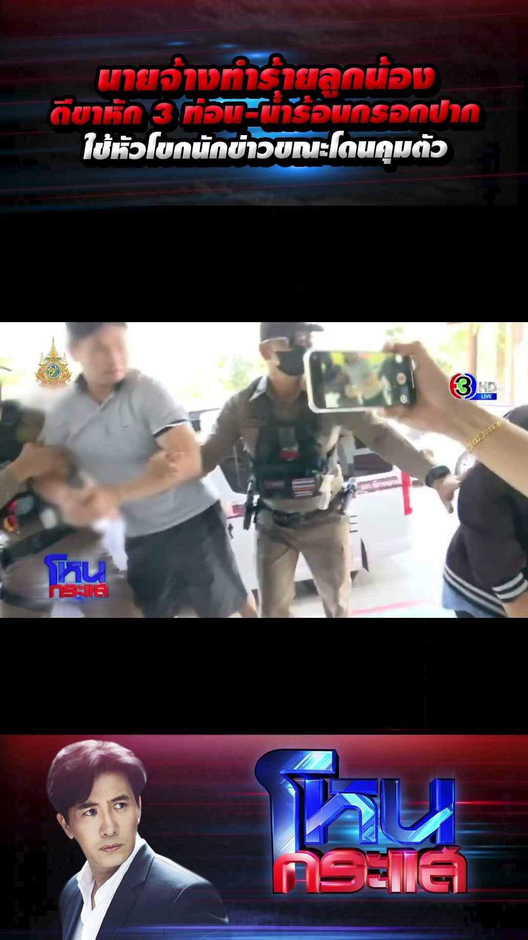 นายจ้างทำร้ายลูกน้อง ตีขาหัก 3 ท่อน-น้ำร้อนกรอกปาก ใช้หัวโขกนักข่าวขณะโดนคุมตัว  l#โหนกระแส