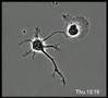 A normal neuron and a mutated neuron develop side by side
