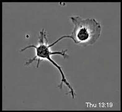 A normal neuron and a mutated neuron develop side by side.