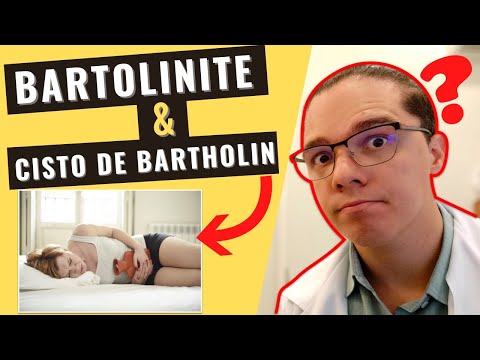 Vídeo: Cisto Da Glândula De Bartholin - Causas, Sintomas E Remoção Do Cisto Da Glândula De Bartholin