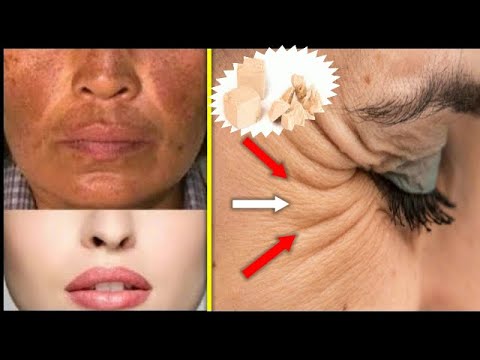 Video: Den Beste Masken For Sliten Hud