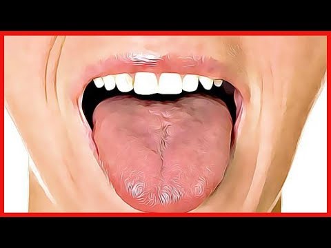6 remedios caseros para curar las llagas de la lengua