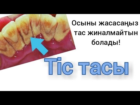 Бейне: Тіс щеткасын таңдаудың 3 әдісі