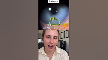 Trichiasis…What To Do With A Tiny Ingrown Eyelash