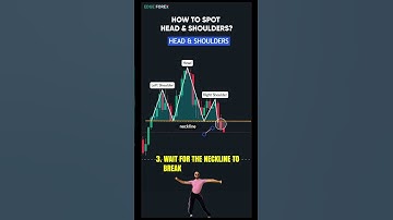 Master the Head & Shoulders Pattern – The Ultimate Guide to Spotting Trend Reversals! 📉🚀