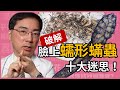 破解蠕形蟎蟲十大迷思，皮膚科林政賢醫師一一幫你破解。